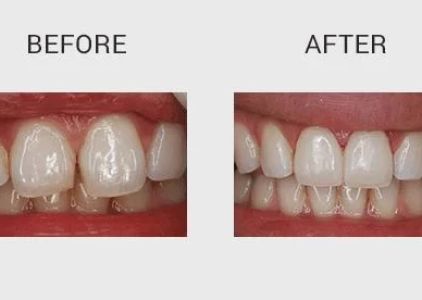 Enhance Dentist