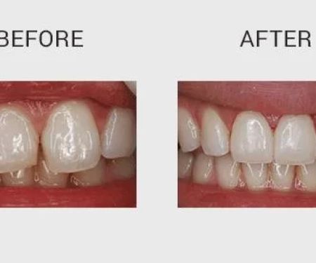 Enhance Dentist