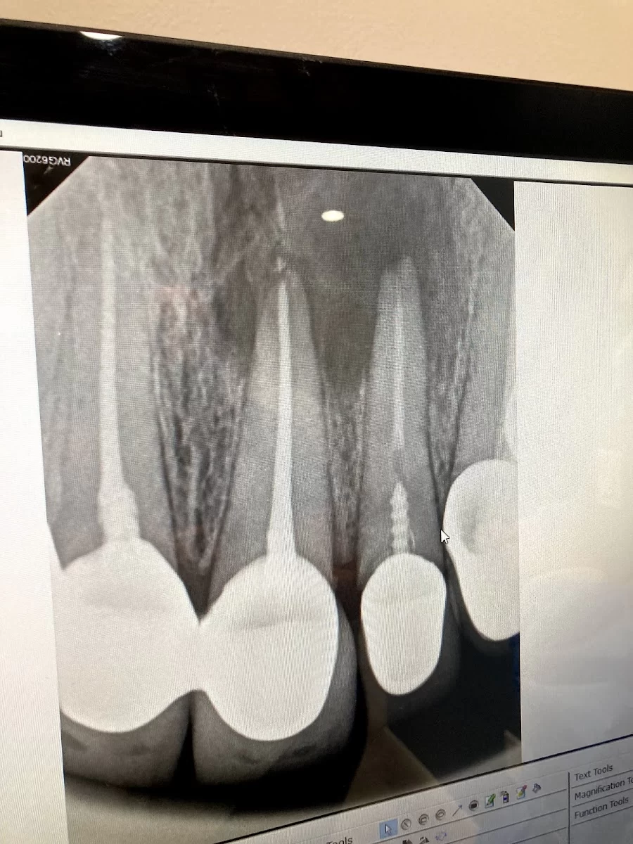 L.A. Smiles Endodontics: Kristina Shagramanova DDS 8