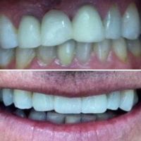 Afsoon Gerayli DDS ico
