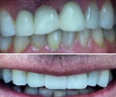 Afsoon Gerayli DDS