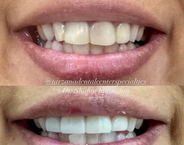 Shahin Shamsian DDS