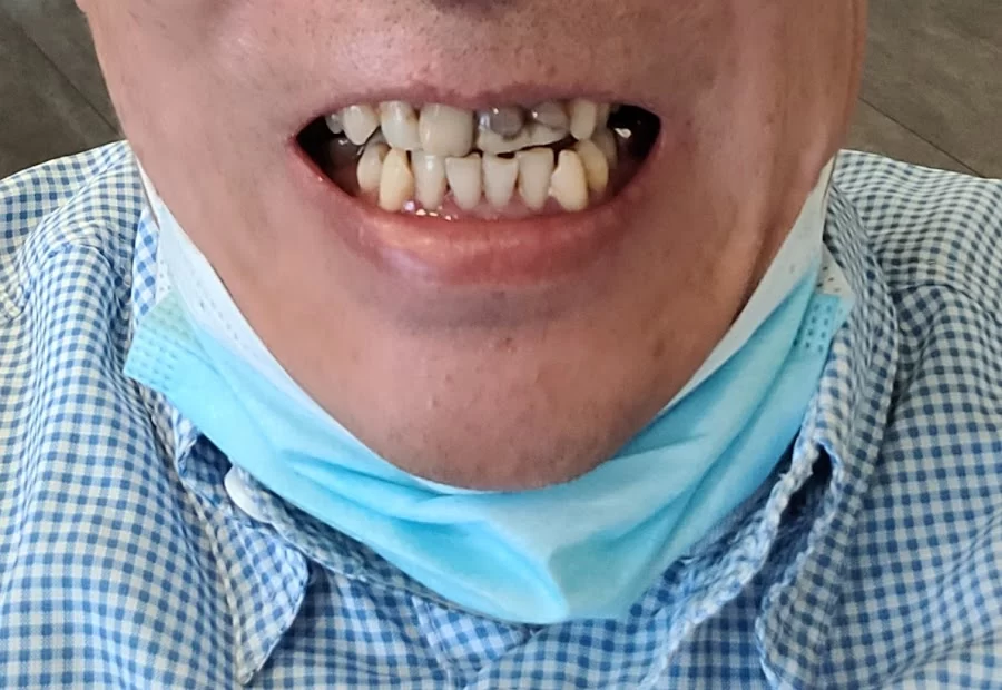 Digital Dental 8