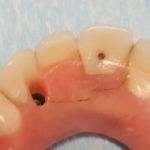 ClearChoice Dental Implant Center