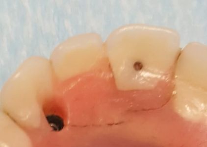 ClearChoice Dental Implant Center