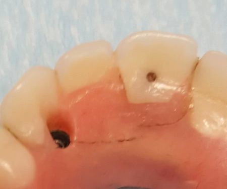 ClearChoice Dental Implant Center