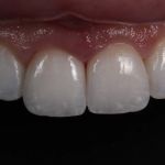 Burbank Dental Lab