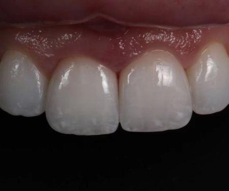 Burbank Dental Lab