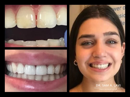 Dr. Sam Lavi Cosmetic and Implant Dentistry 3