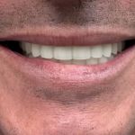 SYGMA DENTAL | Toni Sami DDS | Implants & Cosmetic Dentistry