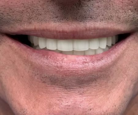 SYGMA DENTAL | Toni Sami DDS | Implants & Cosmetic Dentistry
