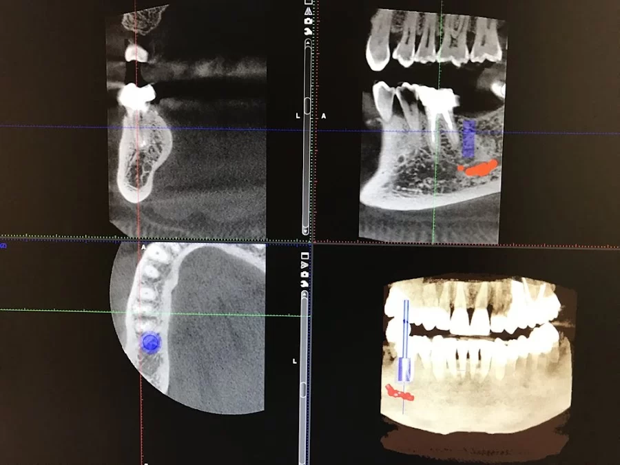 Saryan Dental 5