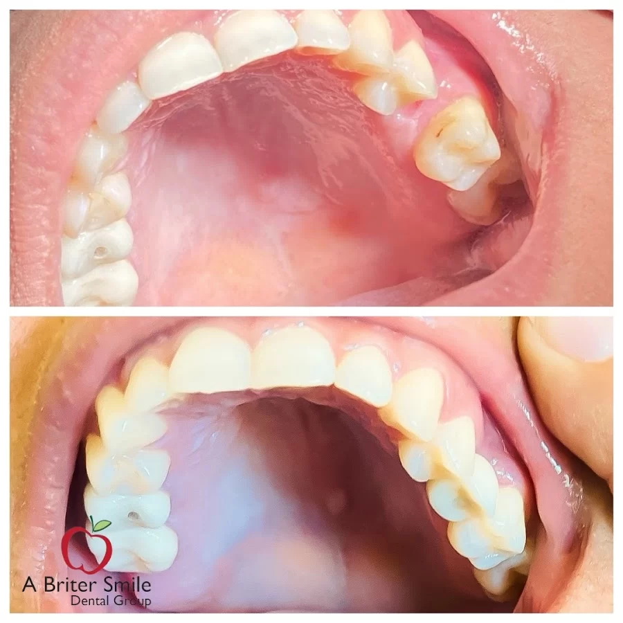 Ali Khosrovani, DDS 5