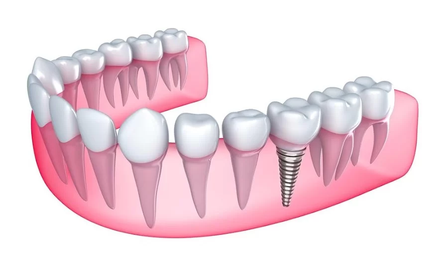 Fair Oaks Family Dental 1