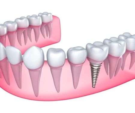 Fair Oaks Family Dental