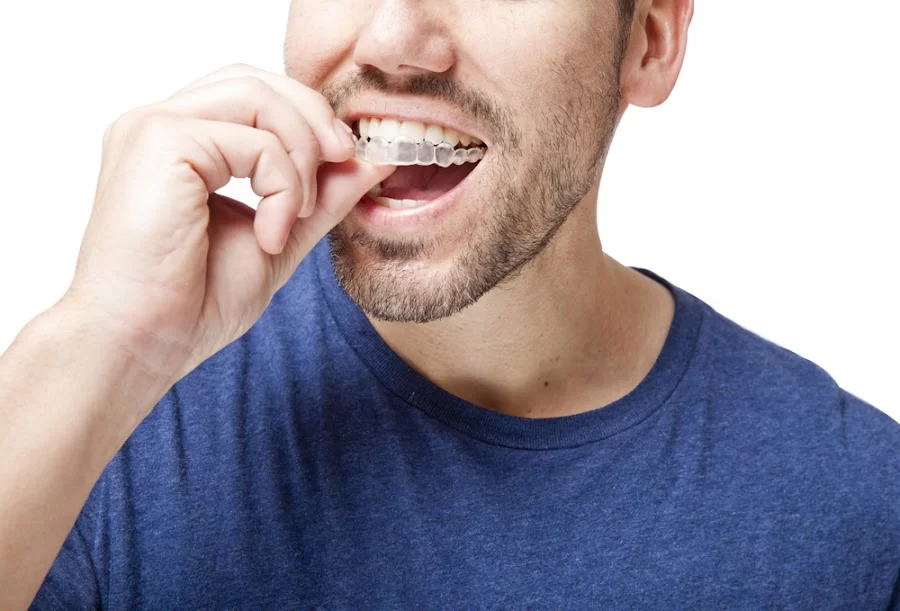 EMBRACE ORTHODONTICS 4