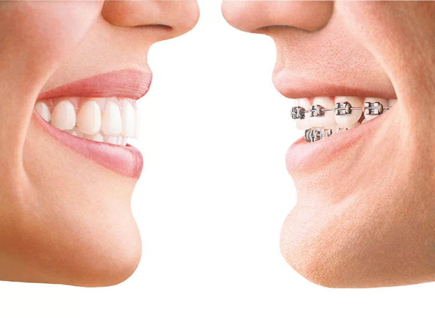 EMBRACE ORTHODONTICS 2