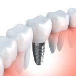 Lake Eola Dental