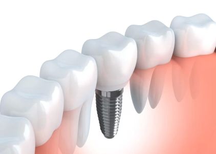 Lake Eola Dental