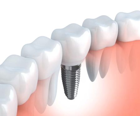 Lake Eola Dental