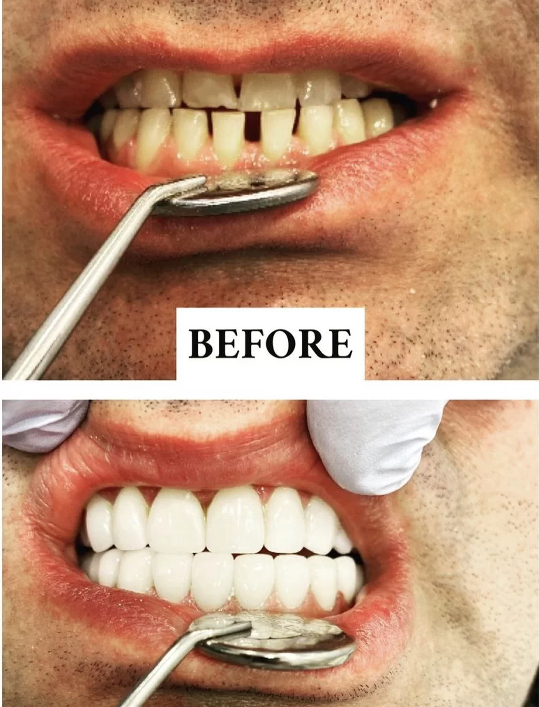 Crystal Bright Smile , Cosmetic & General Dentistry 8