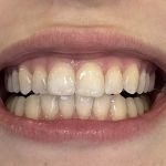 Crystal Bright Smile , Cosmetic & General Dentistry