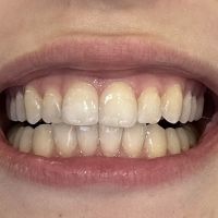 Crystal Bright Smile , Cosmetic & General Dentistry ico