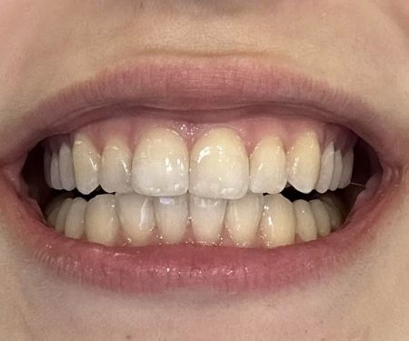 Crystal Bright Smile , Cosmetic & General Dentistry