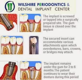 Wilshire Periodontics & Dental 3