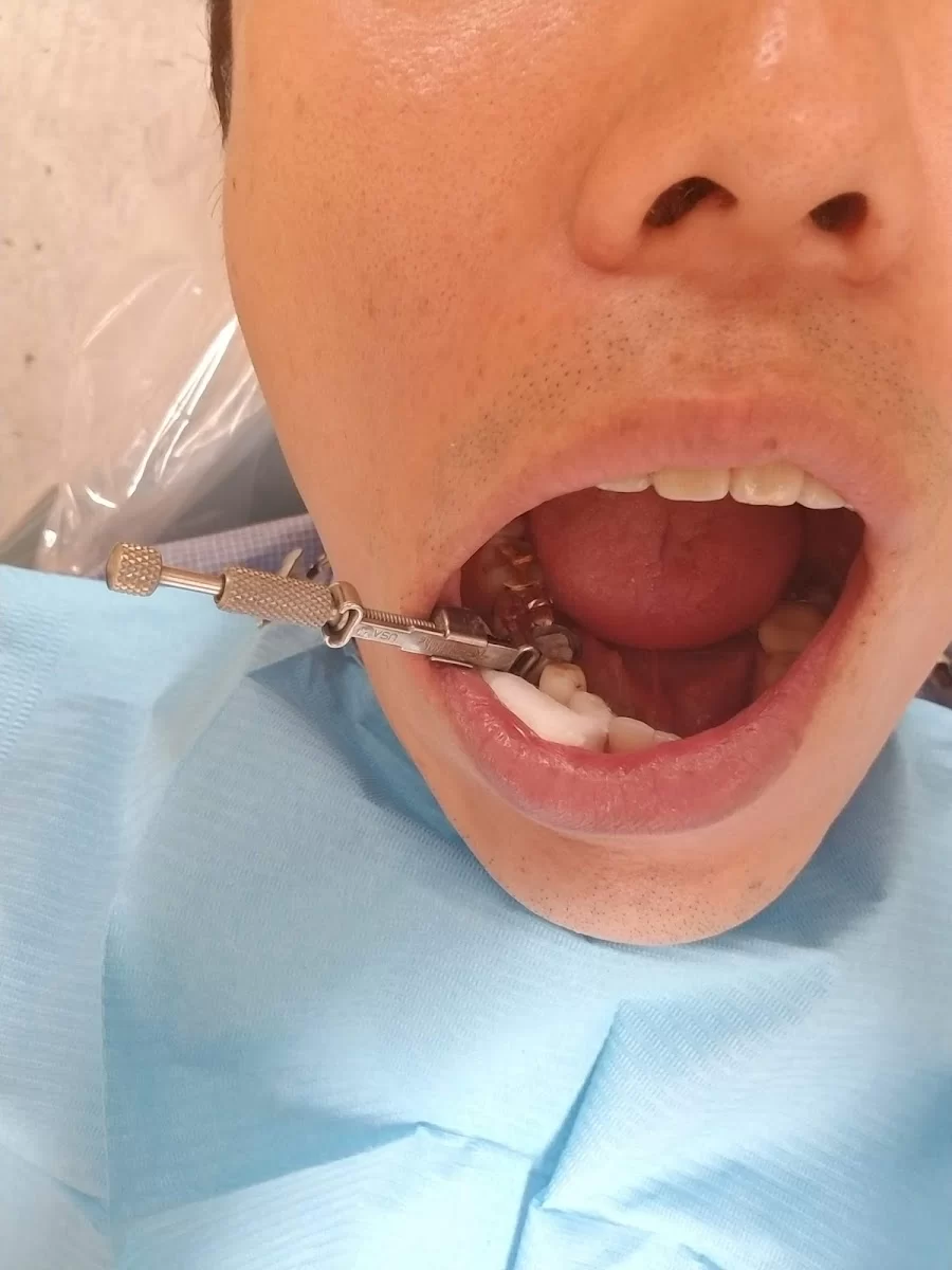 명치과 IMPLANT Dental office 10