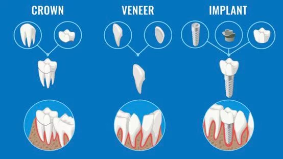 명치과 IMPLANT Dental office 4