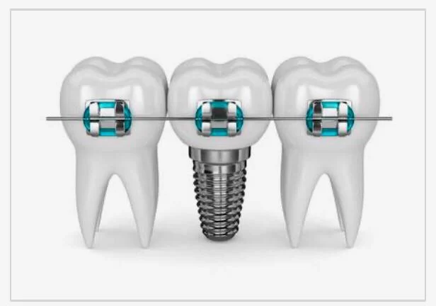 명치과 IMPLANT Dental office 5