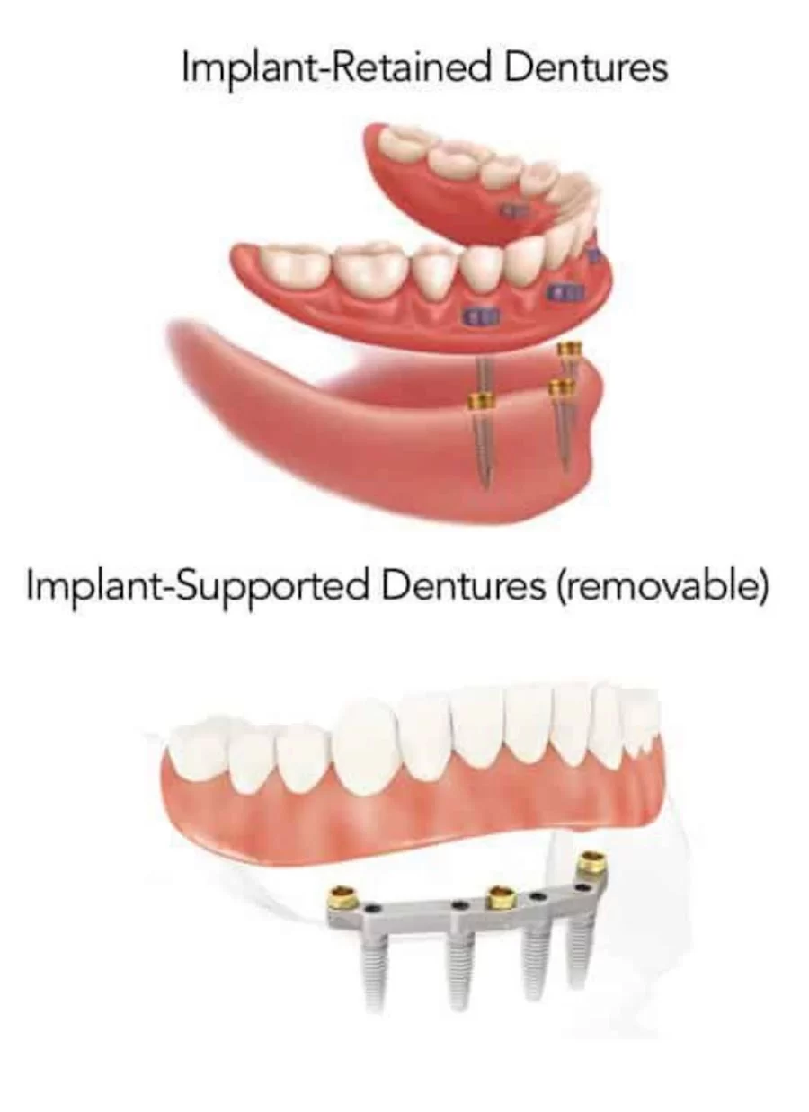 명치과 IMPLANT Dental office 6