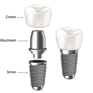 명치과 IMPLANT Dental office 1