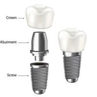명치과 IMPLANT Dental office ico