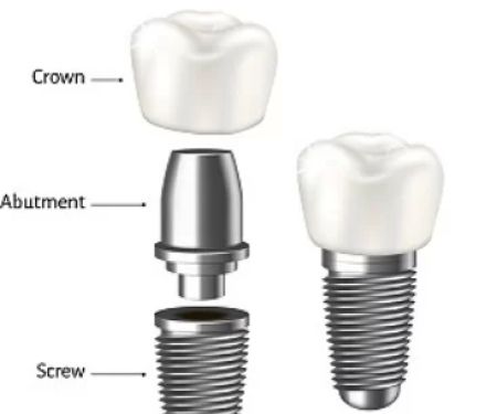 명치과 IMPLANT Dental office