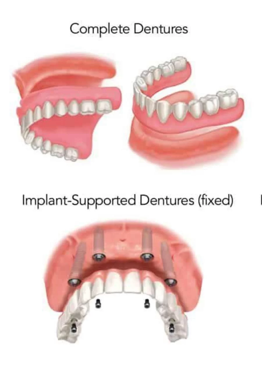 명치과 IMPLANT Dental office 9