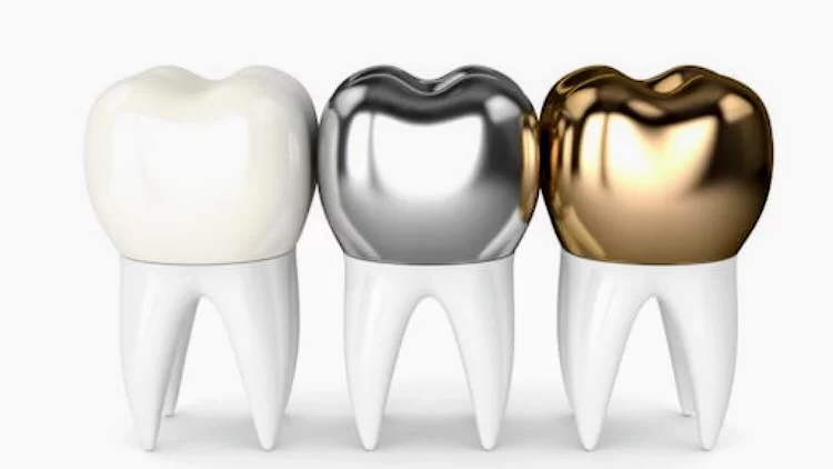 명치과 IMPLANT Dental office 8