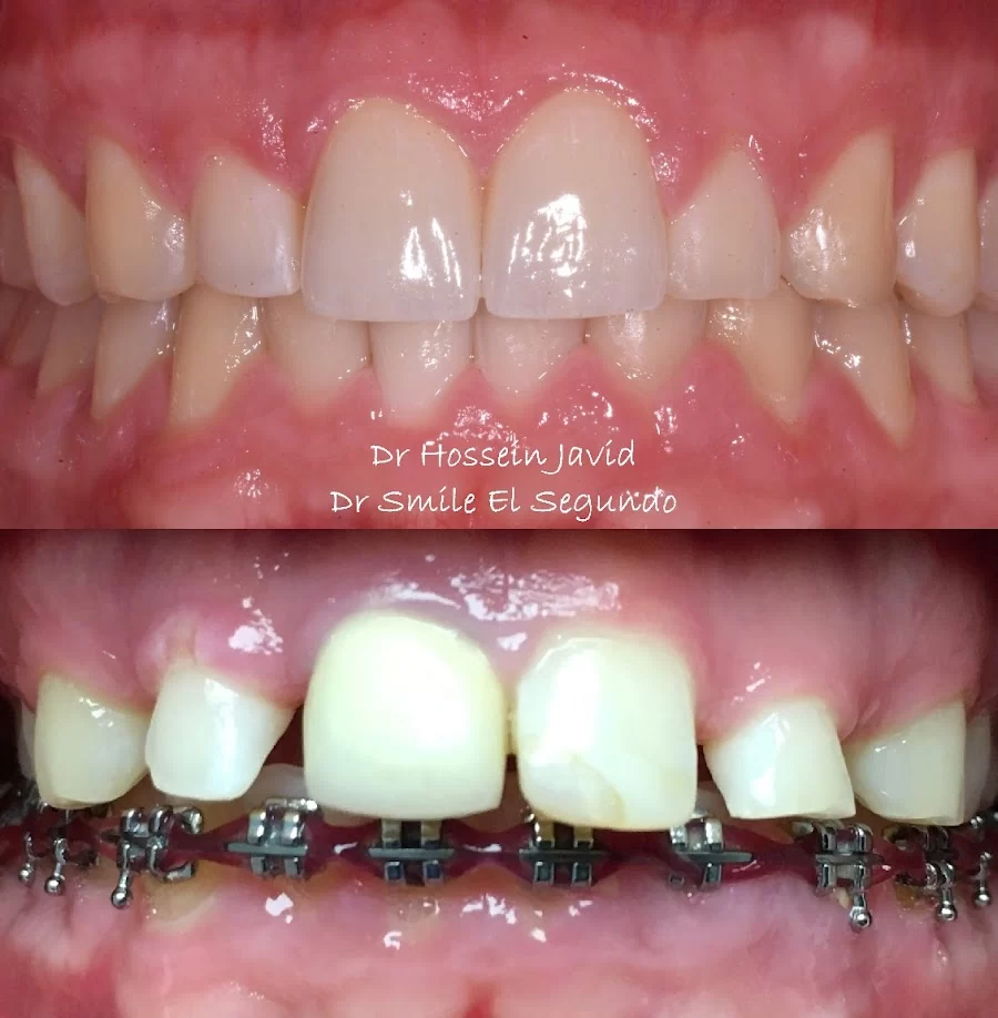 Toothopia Dental - El Segundo (Formerly Dr Smile ) 6