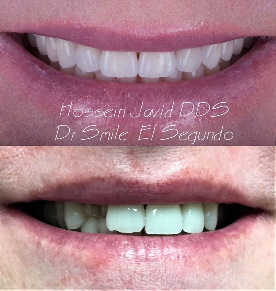 Toothopia Dental - El Segundo (Formerly Dr Smile ) 8