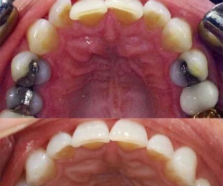 Dental Solutions