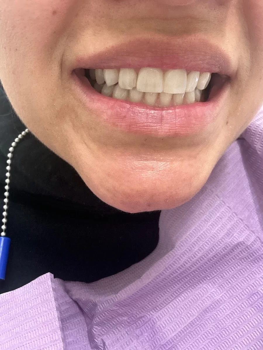 Hoover Dental Center 4