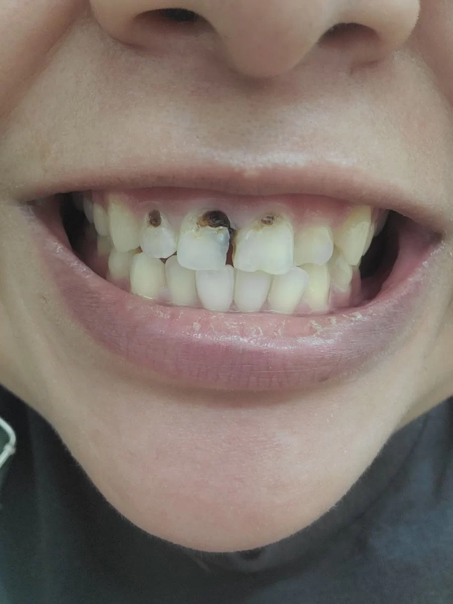 Hoover Dental Center 3