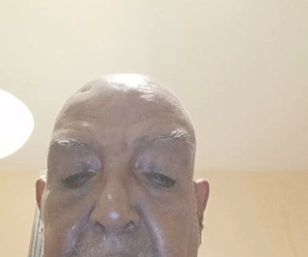 Dr. Raymont H. Johnson Jr, DDS