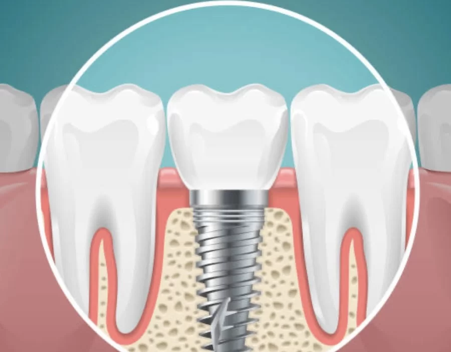 Elite Dental Group SE Colorado Springs 4