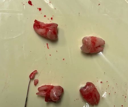 LAX DENTAL and ORTHODONTICS