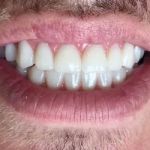 Koyfman Dental