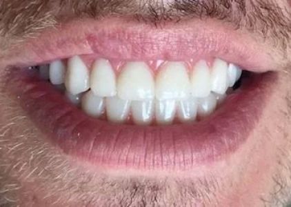 Koyfman Dental