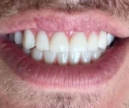 Koyfman Dental