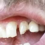West One Family Dental
